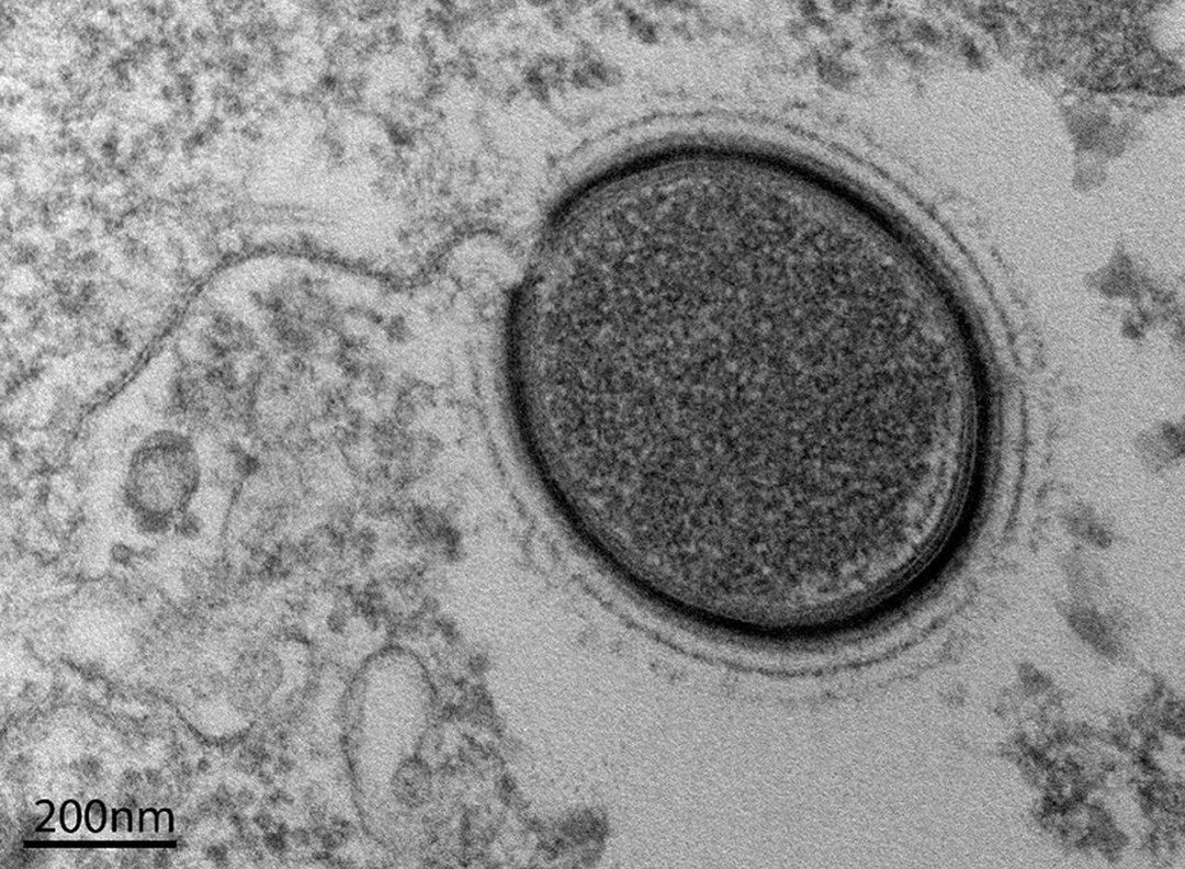 为了永生,科学家给自己注射350万年前的细菌,结果如何?