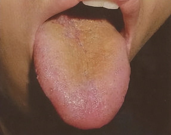 健脾|藿香正气水不能解暑!化湿行滞,发散风寒的良药,别再用错了