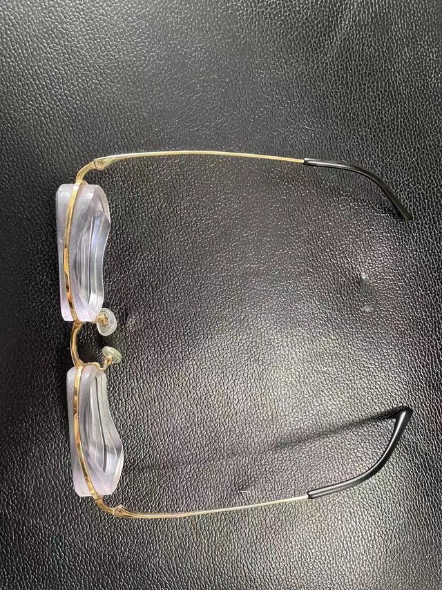 近视|近视3000多度，4次眼球手术“无计可施”， 无奈只能摘眼球