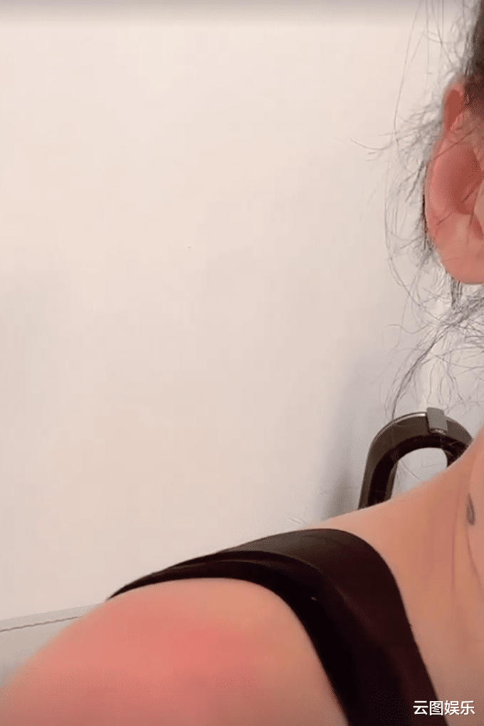 张柏芝|41岁张柏芝太拼了!为卖货将肩膀皮肤晒得又红又肿,直呼真的很痛