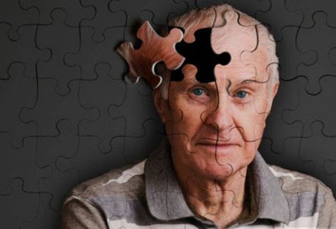 甲状腺结节|研究发现：卵磷脂或可预防老年痴呆？4种高卵磷脂食物，或可多吃