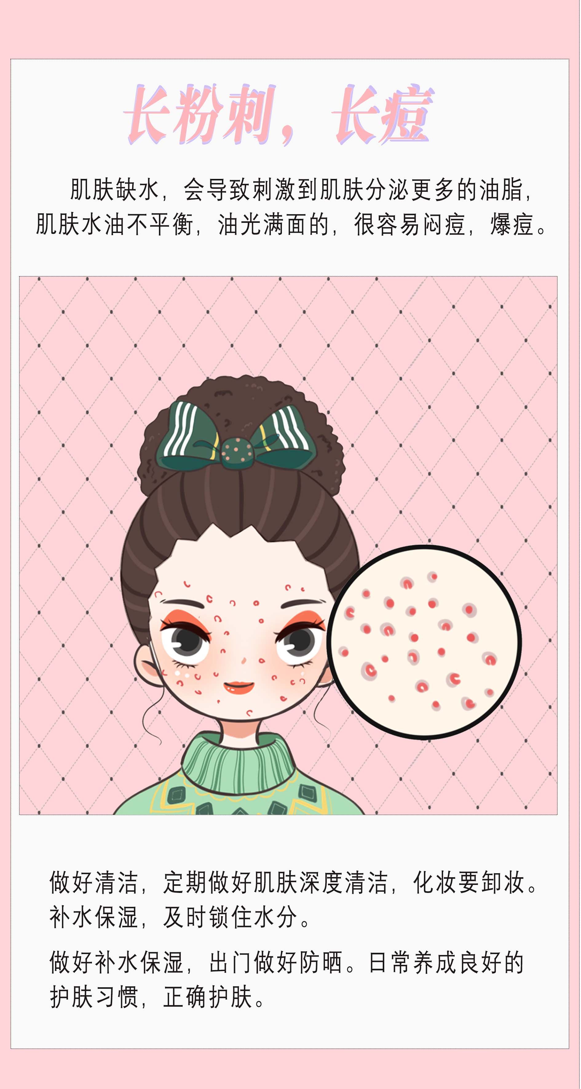 短发 祛痘膏在护肤哪个步骤