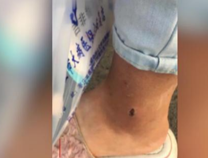 大妈公交车上惹众怒,为抢座猛踹骨折女子,司机直接开到派出所