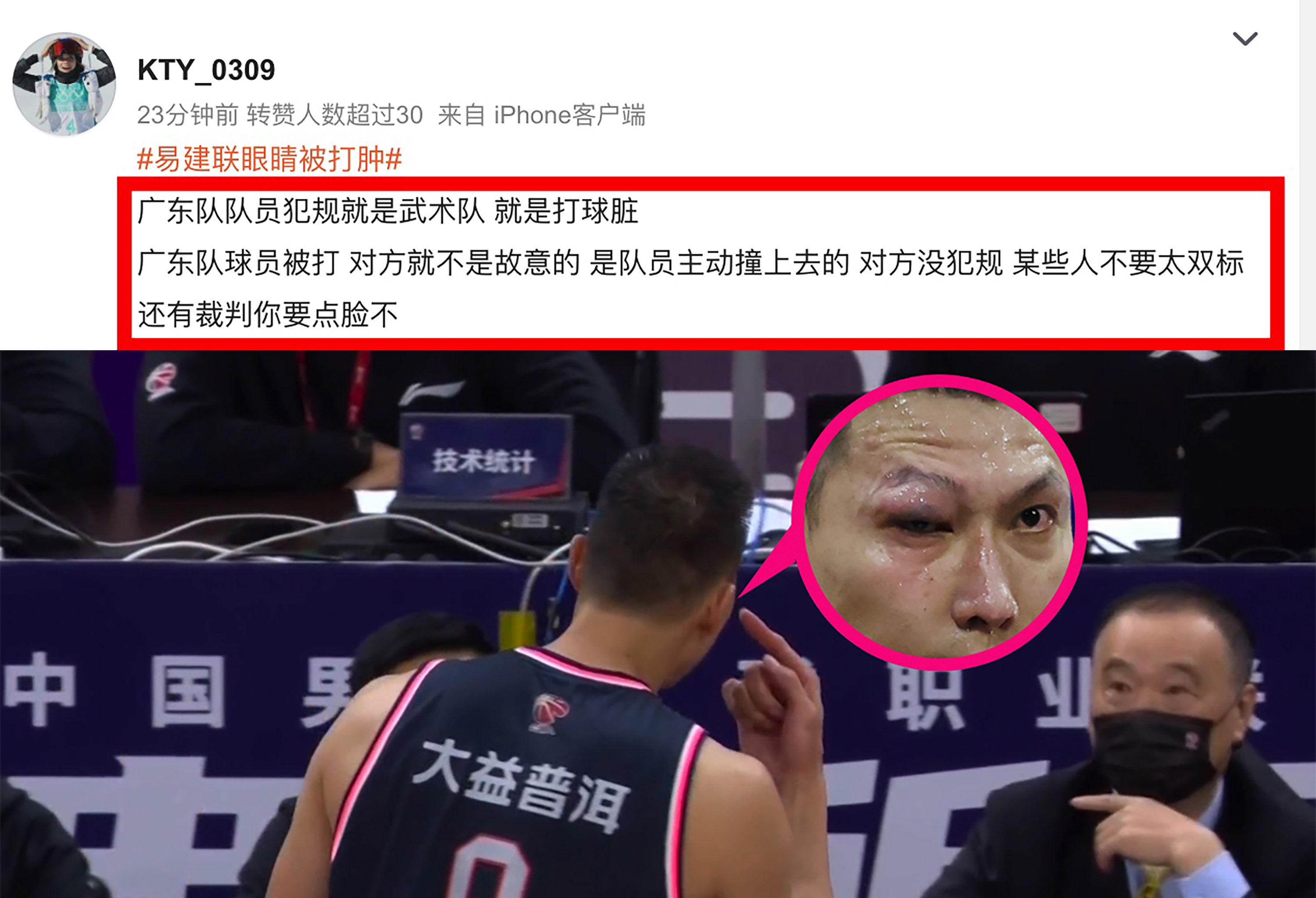 易建联|时隔16小时，易建联受伤照片遭到PS，球迷对立情绪引担忧