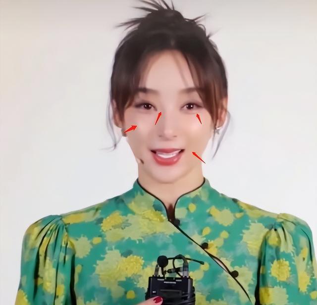 袁姗姗|袁姗姗近照变样，鼻尖嘴歪脸僵硬到认不出，被疑整容模样撞脸柳岩