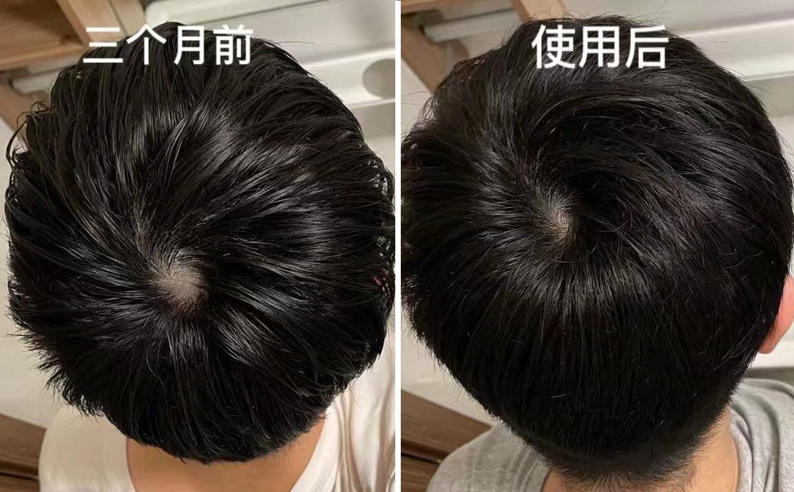 碳水化合物 双11囤货指南!男士从头到脚精致好物清单分享
