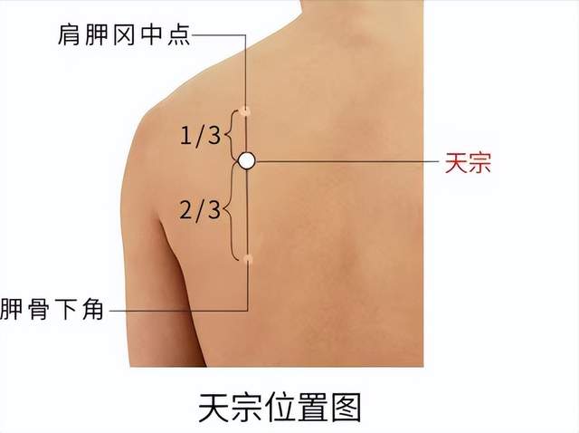 乳腺增生|经络穴位,一日一学——天宗,缓解肩痛,还能预防乳腺增生