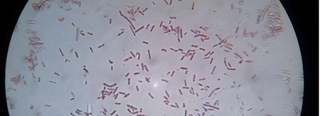 2013年,俄罗斯科学把350万年前细菌注射到自己体内,后来怎样了