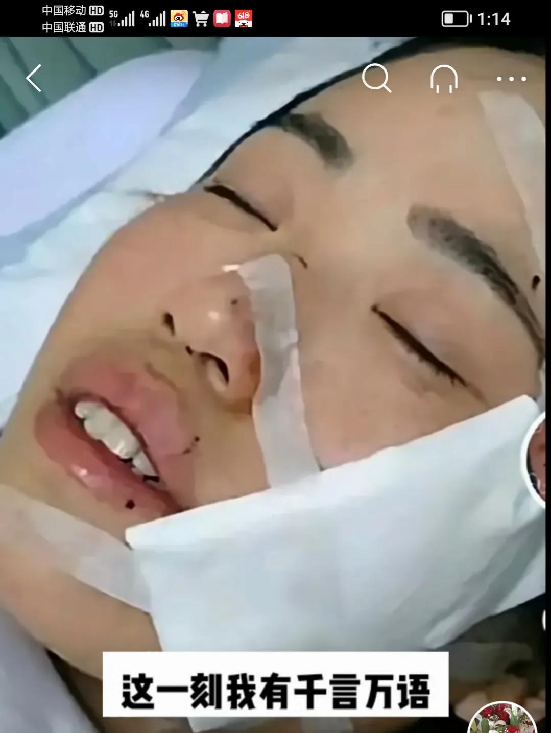 唐山被打女孩已破相,脸上脖子上有很深的血口子