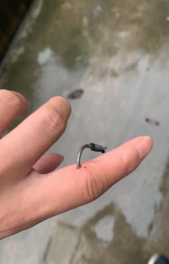 |盘点钓鱼人各种花式钓自己，看着就很疼！预防和处理方法分享