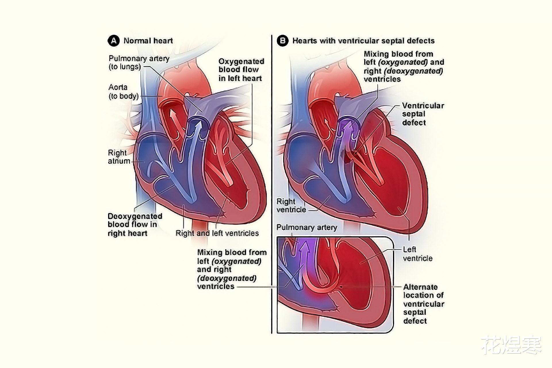 那山那海|《那山那海》别被林月仙吓破胆，这病没有传说的那么可怕！