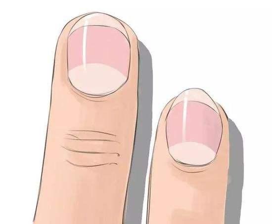 阿尔茨海默病|血管光滑,寿命长?中医:谨记5行为,血管不堵塞有弹性