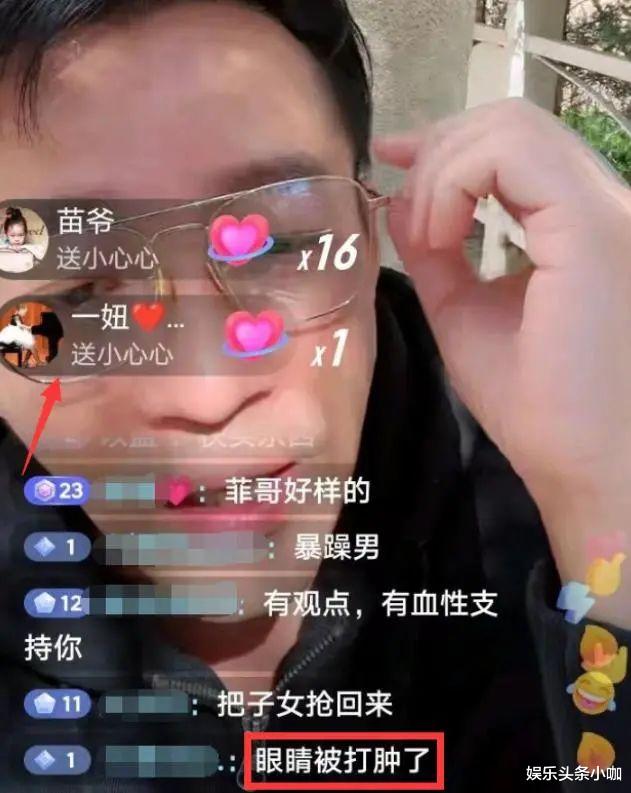 汪小菲|不是吧，汪小菲被人打了？