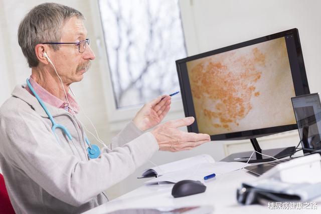 |美国研究：富含脂肪和糖的饮食可能会导致炎症性皮肤病