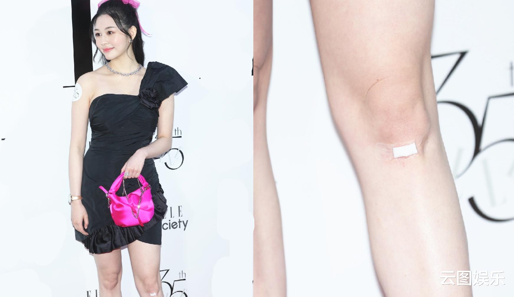 邱淑贞|邱淑贞女儿参加派对,穿短裙膝盖受伤,30岁男星脸上缝6针现身