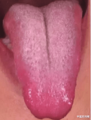 失眠|失眠反复总不好？找到原因是关键，医生教你如何“告别”失眠