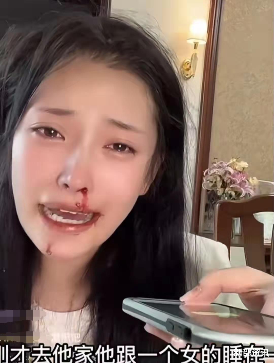 气愤!美女网红被男友暴打,满脸血边直播边报警,男友被扒是惯犯
