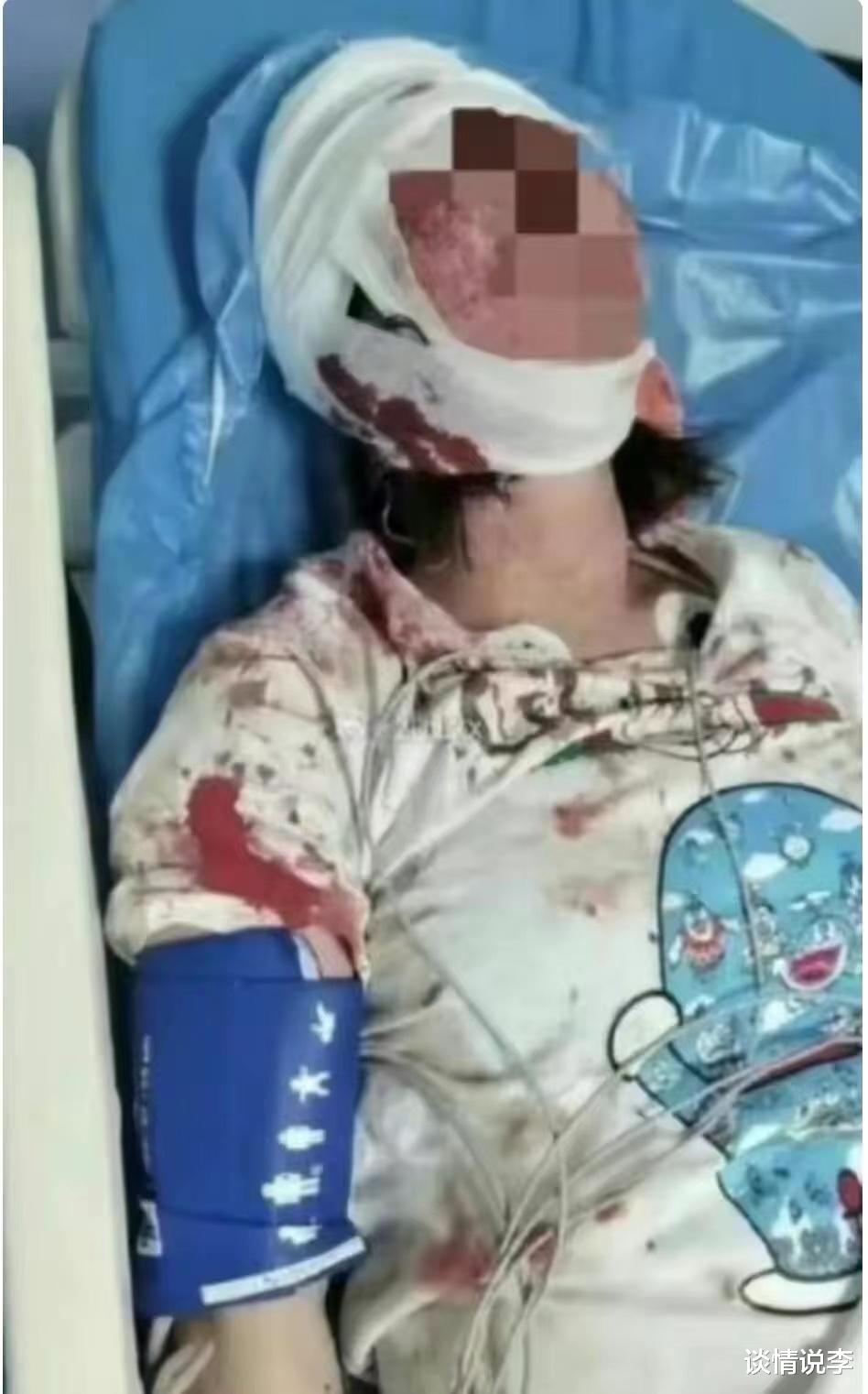 唐山4名被打女子集体选择了沉默,39天依然雾里看花,真相是啥?