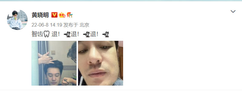 黄晓明|脸肿表情包+1！黄晓明晒拔完智齿后自拍，好像被蜜蜂蛰的狗狗