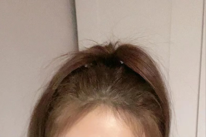 发饰 修饰发际线及鬓角的小脸秘诀,夏天扎马尾盘头发也不怕