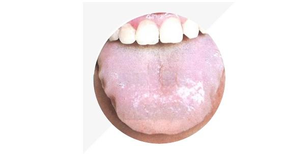 身体的秘密|中医要看舌头的原因，原来是舌头隐藏着身体的秘密，还会发生变化