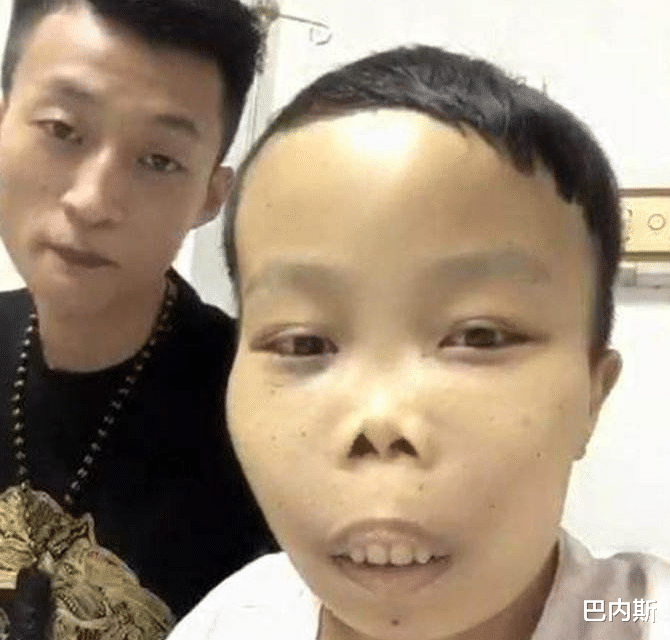 花滑|“外星人”陈山升级当爸爸，婴儿外表无异常，被怀疑是不是亲生的