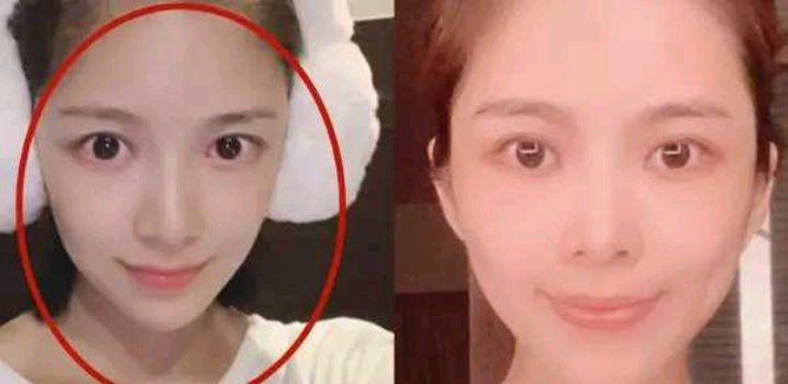 王灿|杜淳老婆王灿罕发文：我33岁并非47岁，“瘢痕体质”所以顺产生子