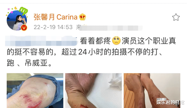 林峰|林峯拍戏意外受伤！胳膊多处伤口红肿严重，表面皮肤受损露出血肉