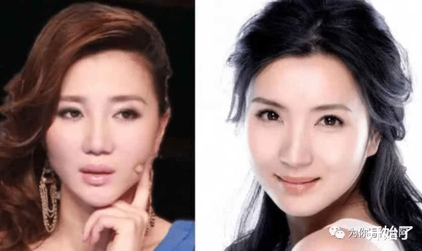 脸盲症|“脸盲症”犯了!娱乐圈中6对“撞脸”的女星,让人傻傻分不清楚