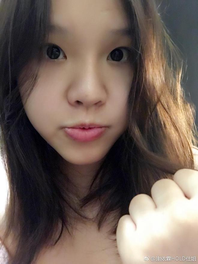 谢依霖|谢依霖自曝10年前曾整鼻 自嘲推起来像“节拍器”