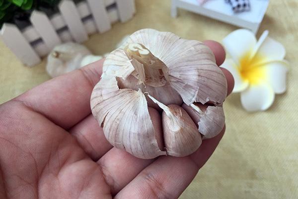 痛风|脑供血不足,可能是这3个原因在“惹事”!针对预防可以“驱逐”