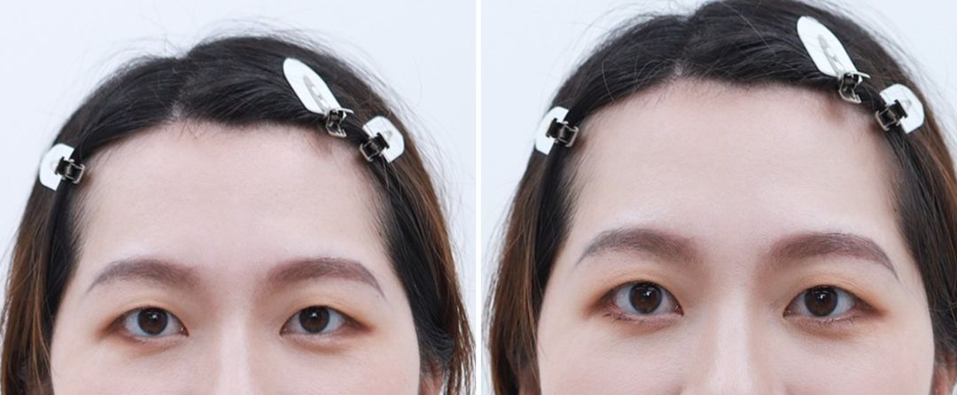 面膜|单眼皮长脸女孩,真的可以好好打扮一番