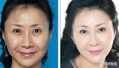 温碧霞|长期使用精华的皮肤,三年后会变成什么样子?说出来你都不敢相信
