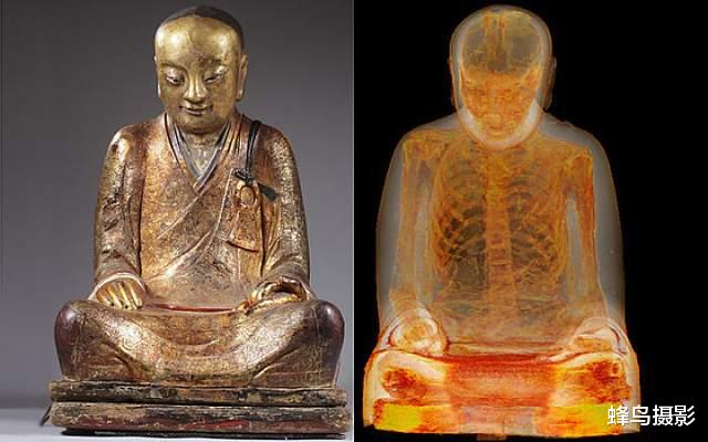 30张活久未见的照片,完整的人类神经系统,全世界只有4个