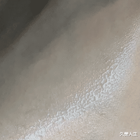 医美 从没想到自己有一天能这么绿！