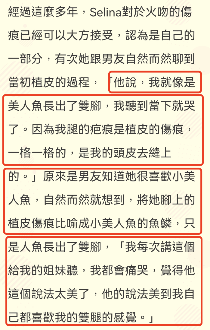 肖战|太治愈了！Selina被烧伤后留疤，被男友形容是美人鱼的鱼鳞
