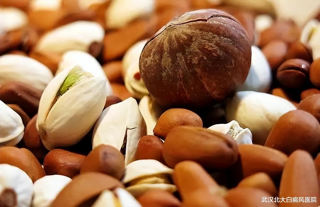 心肌梗塞|身边这5种食物，对白癜风康复有好处！快来了解一下