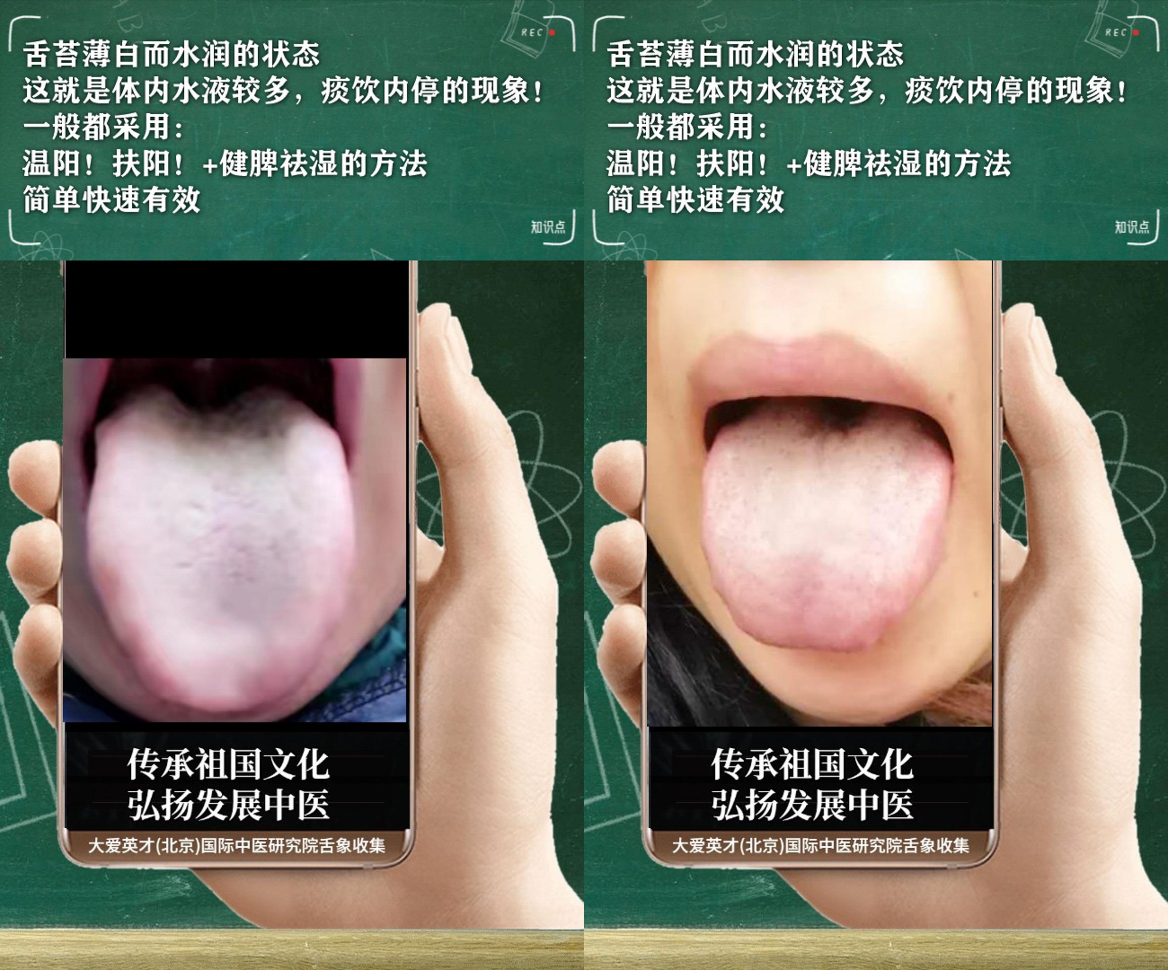 内分泌失调|中医医案:易愤怒、内分泌失调、慢性鼻炎、时好时差很影响生活