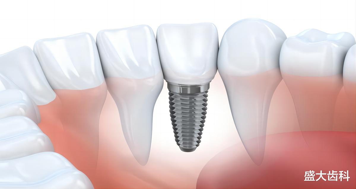 医院|如何选择合适的假牙?