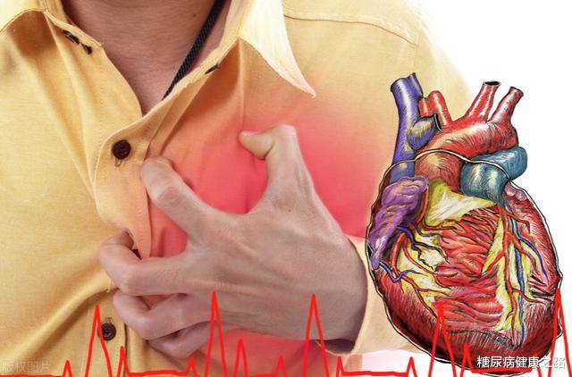 冠心病|糖尿病并发冠心病，如何正确饮食？推荐5种食物，牢记膳食口诀