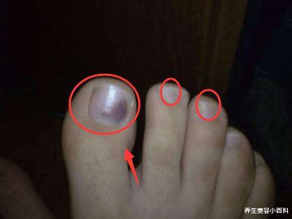 |脚上神秘的“三大特点”, 竟然说明寿命长