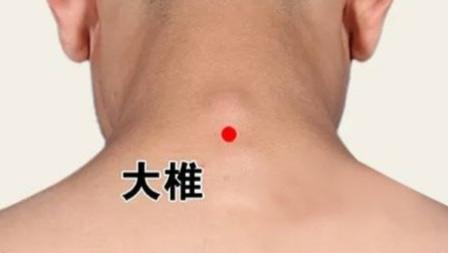 美容 人体美容要穴--祛斑、祛痘