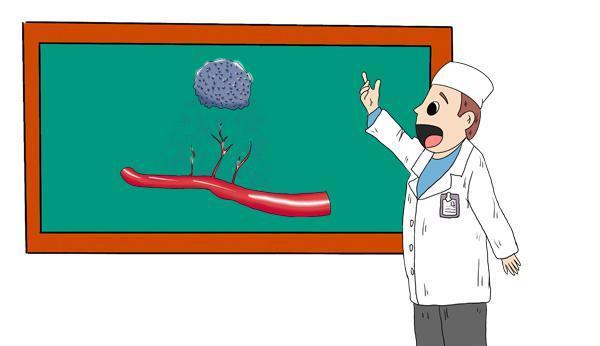 胆结石|饮食致癌的真凶，并不一定是添加剂