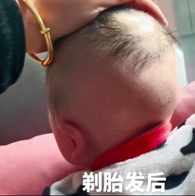 陕西西安一宝宝满月时被父亲用剃须刀刮去头上的毛,结果悲剧了