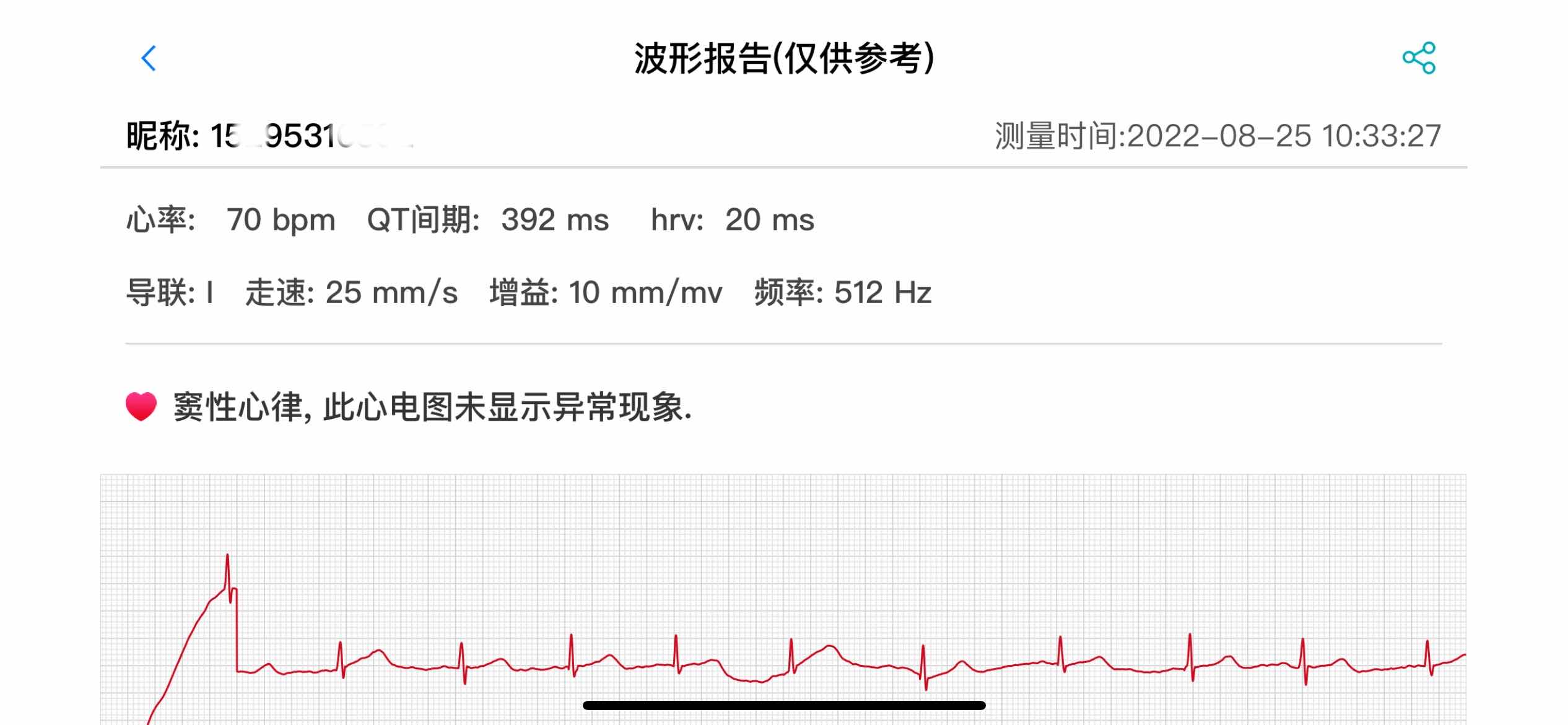 云视频|年轻人的第一款健康智能手表-Dido G28s 心电血压智能手表