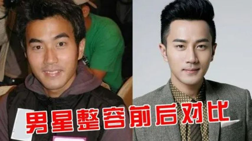 汤唯|8位“改头换命”的男明星，王一博脸已僵硬，刘恺威眼皮才是灵魂