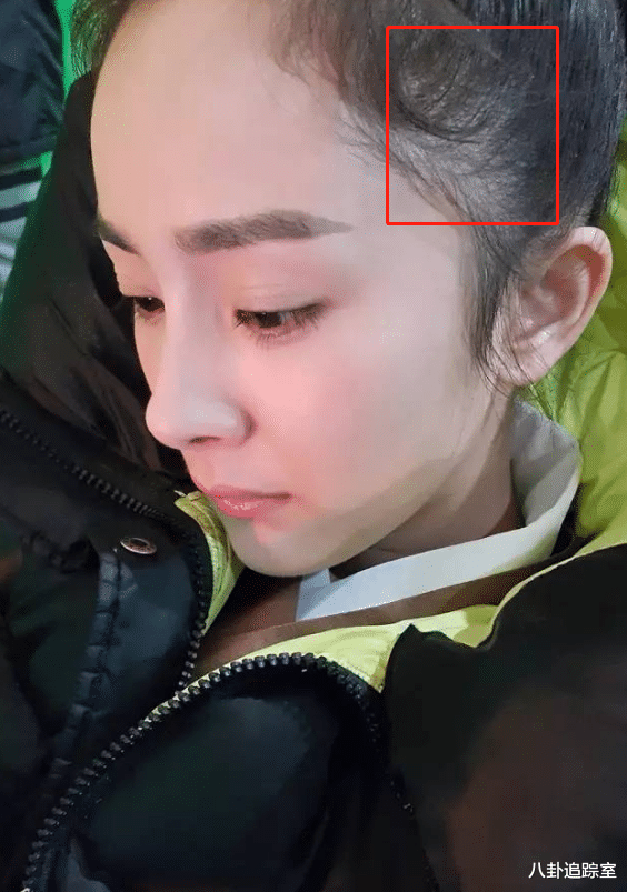 杨幂|杨幂被猜植发,大方自曝正在用“生发液”,网友:请教教好友杨颖