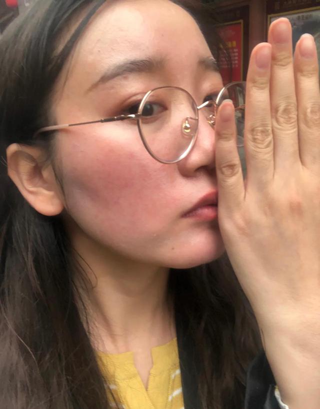 护肤品 判断你是“敏感肌”还是“伪敏感”，记住这几个明显特征，不会错