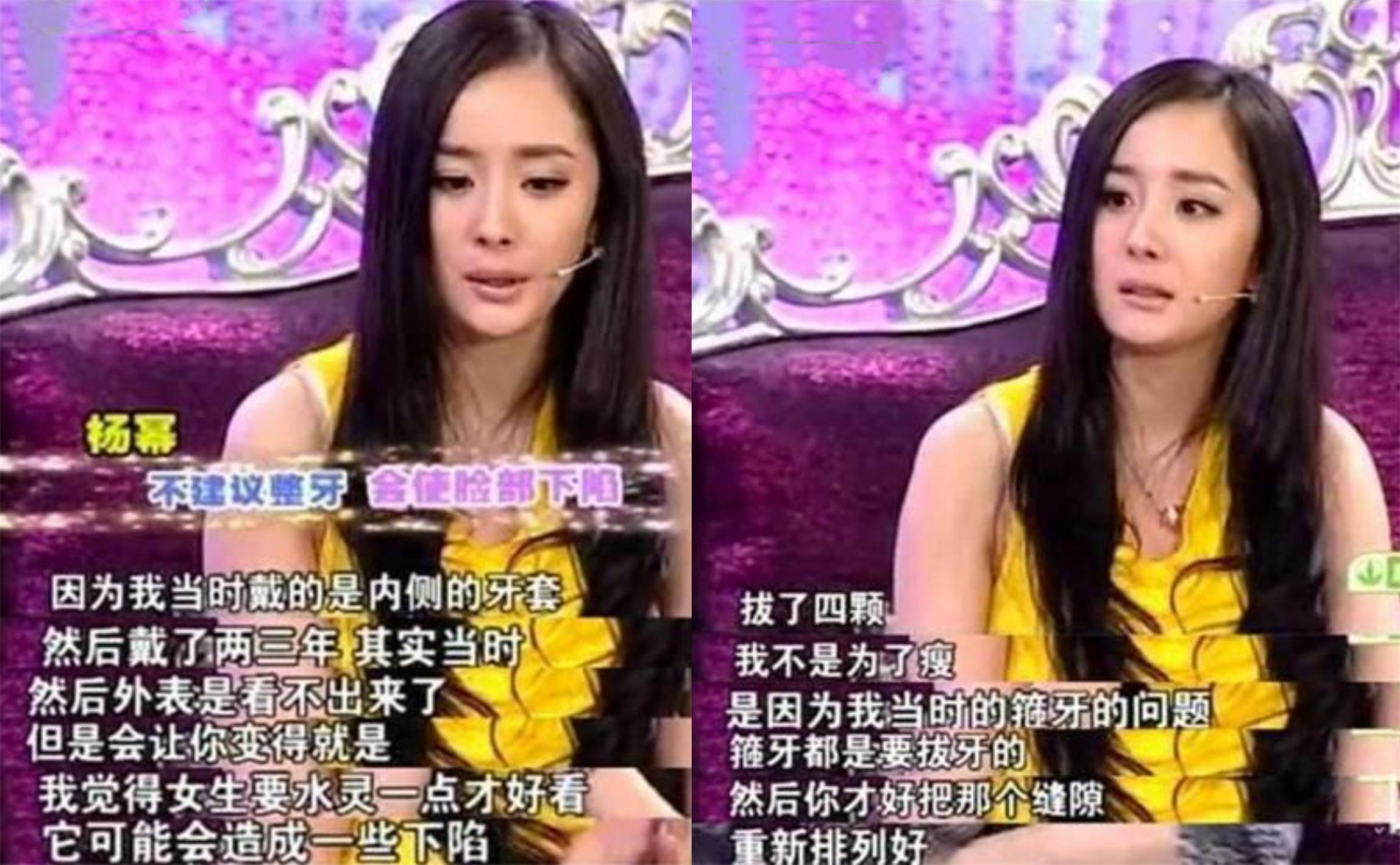 牙齿|整牙如换头,盘点娱乐圈悄悄变美的明星们