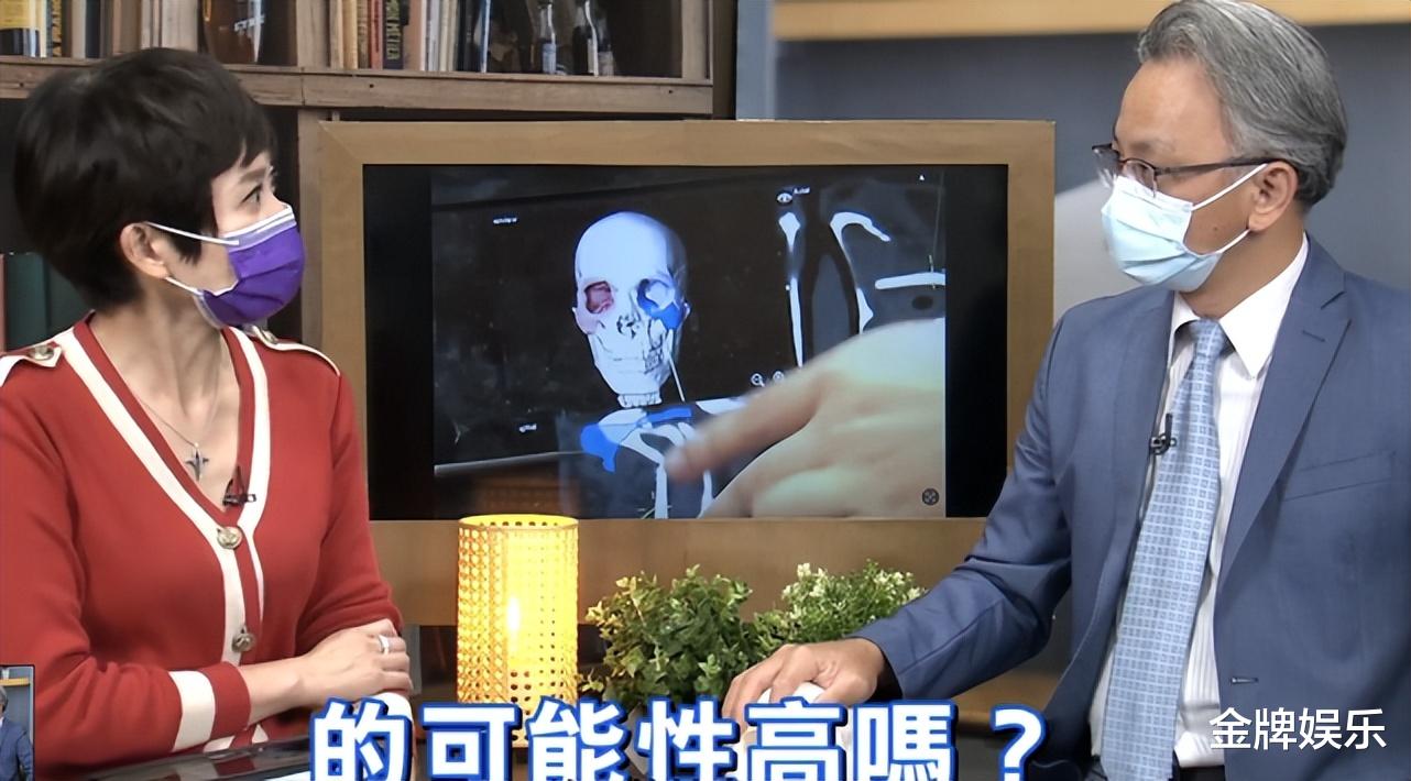 香港|林志颖手术方案出炉:钛合金固定颜面骨,脸型恢复原样可能性很高